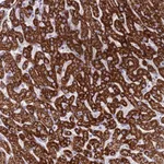 Atlas Antibodies Anti-RNF222 Antibody