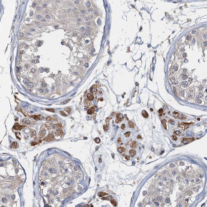 Atlas Antibodies Anti-RNF25 Antibody