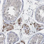 Atlas Antibodies Anti-RNF25 Antibody