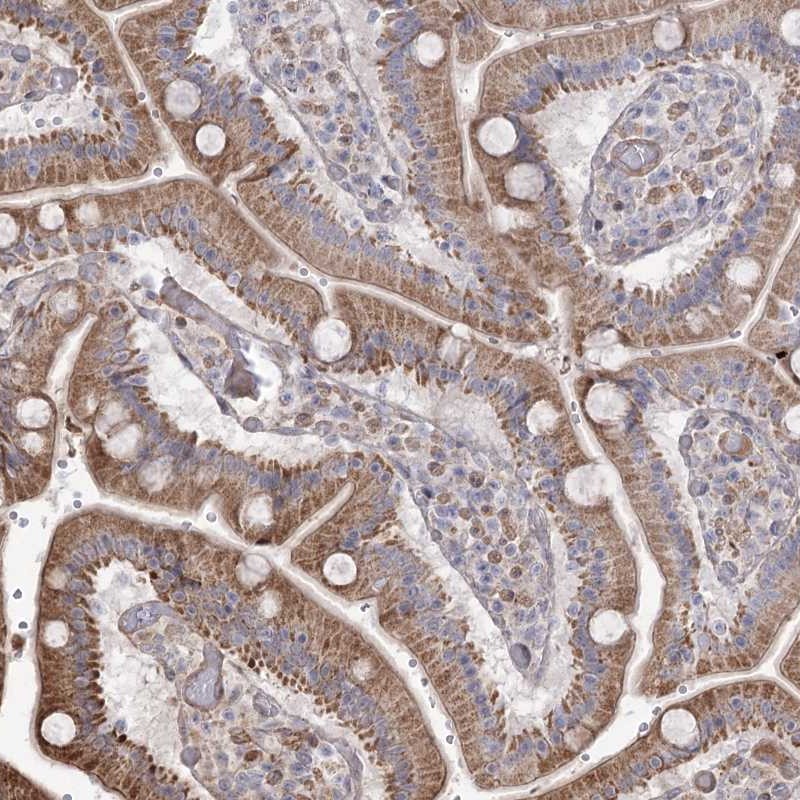Atlas Antibodies Anti-RNF24 Antibody