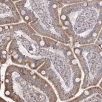 Atlas Antibodies Anti-RNF24 Antibody