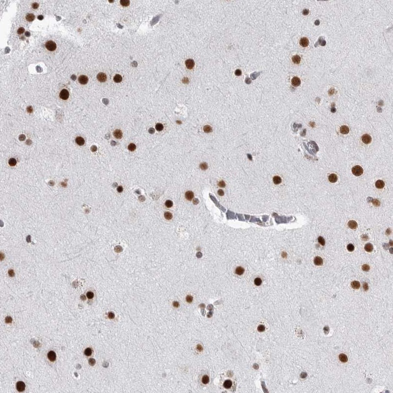 Atlas Antibodies Anti-RNF26 Antibody