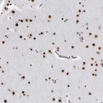 Atlas Antibodies Anti-RNF26 Antibody