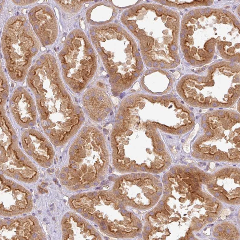 Atlas Antibodies Anti-RNF31 Antibody