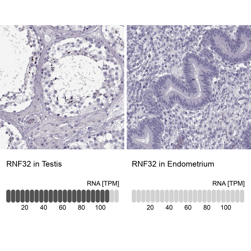 Atlas Antibodies Anti-RNF32 Antibody