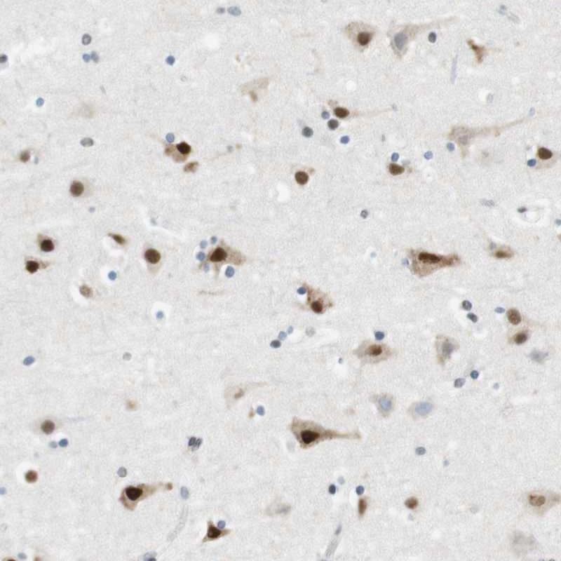 Atlas Antibodies Anti-RNF38 Antibody