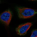 Atlas Antibodies Anti-RNF32 Antibody