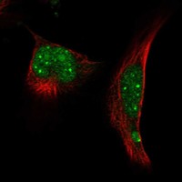 Atlas Antibodies Anti-RNF4 Antibody