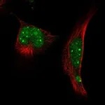 Atlas Antibodies Anti-RNF4 Antibody