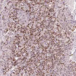 Atlas Antibodies Anti-RNF39 Antibody