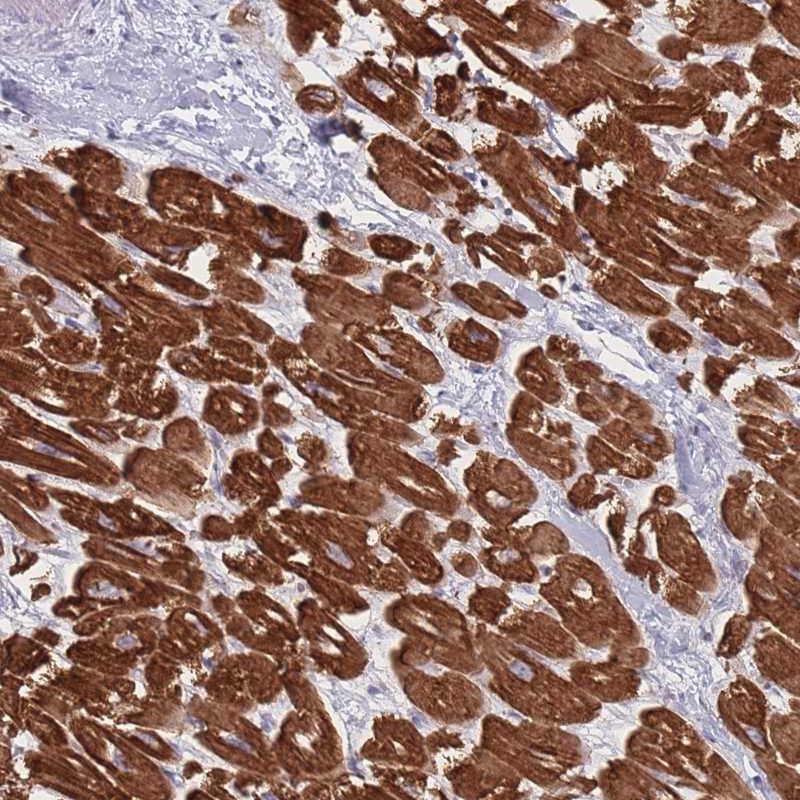 Atlas Antibodies Anti-RNF4 Antibody