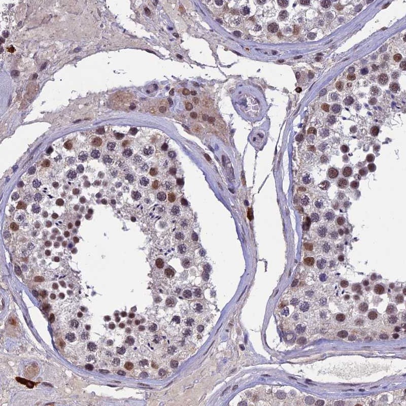 Atlas Antibodies Anti-RNF40 Antibody