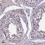 Atlas Antibodies Anti-RNF40 Antibody