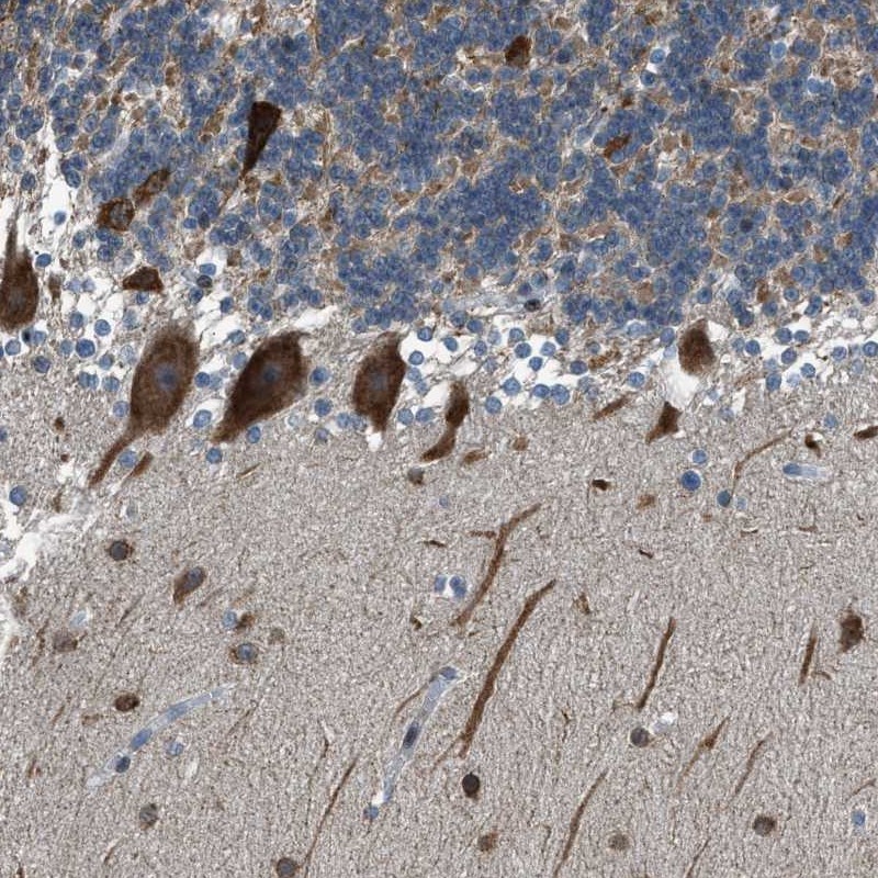 Atlas Antibodies Anti-RNF41 Antibody