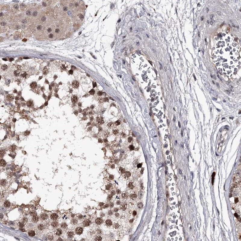 Atlas Antibodies Anti-RNF44 Antibody
