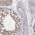 Atlas Antibodies Anti-RNF44 Antibody