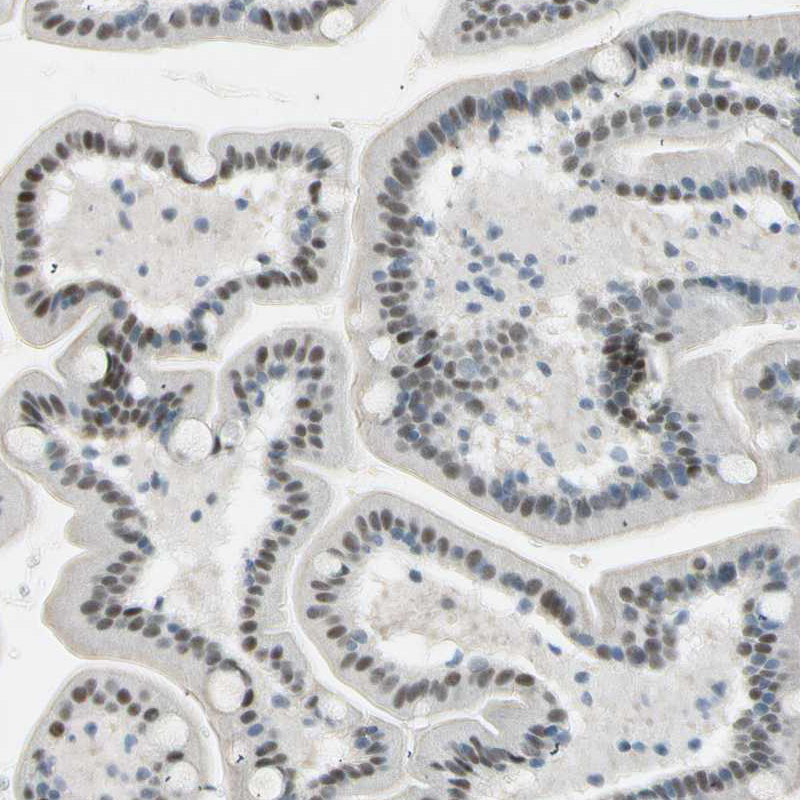 Atlas Antibodies Anti-RNF43 Antibody