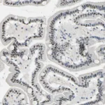 Atlas Antibodies Anti-RNF43 Antibody