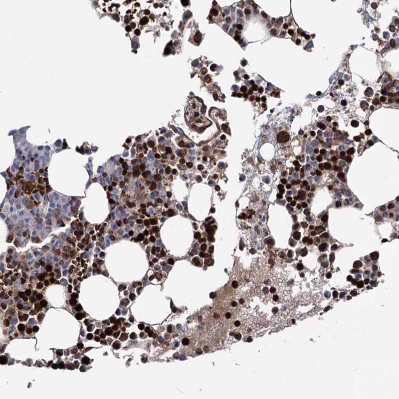 Atlas Antibodies Anti-RNF6 Antibody