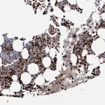 Atlas Antibodies Anti-RNF6 Antibody