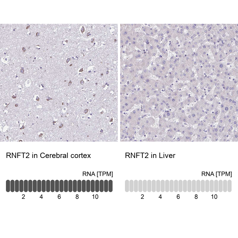 Atlas Antibodies Anti-RNFT2 Antibody