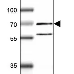 Atlas Antibodies Anti-RNF6 Antibody