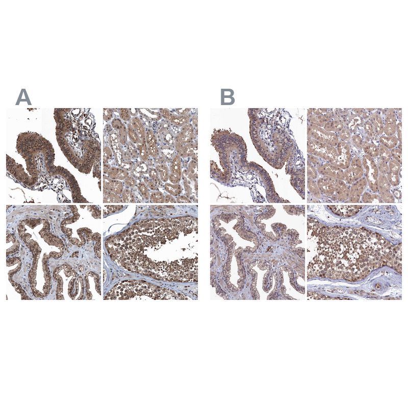 Atlas Antibodies Anti-RNH1 Antibody