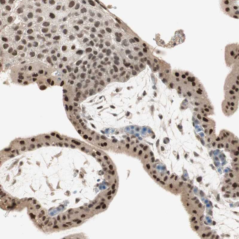 Atlas Antibodies Anti-RNGTT Antibody