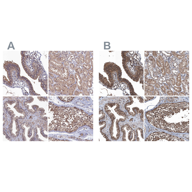 Atlas Antibodies Anti-RNH1 Antibody