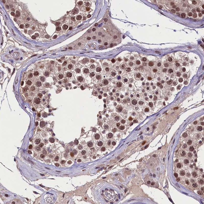 Atlas Antibodies Anti-RNMT Antibody