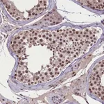 Atlas Antibodies Anti-RNMT Antibody