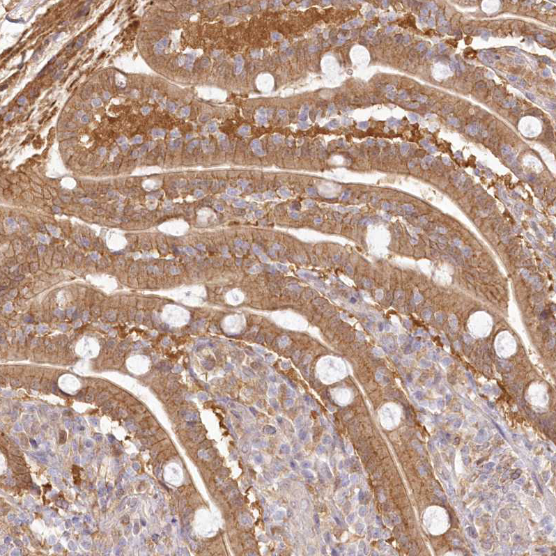 Atlas Antibodies Anti-RNPEP Antibody