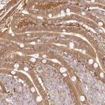 Atlas Antibodies Anti-RNPEP Antibody