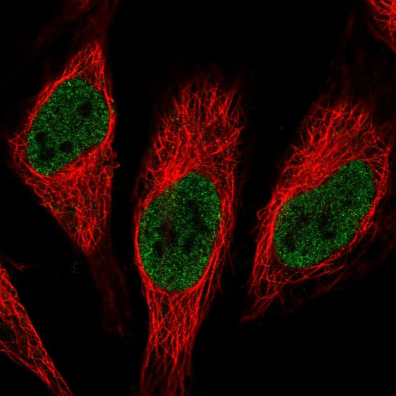 Atlas Antibodies Anti-RNPC3 Antibody