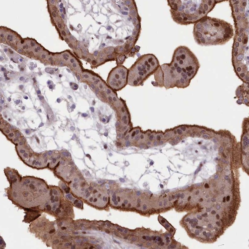Atlas Antibodies Anti-RNPEPL1 Antibody