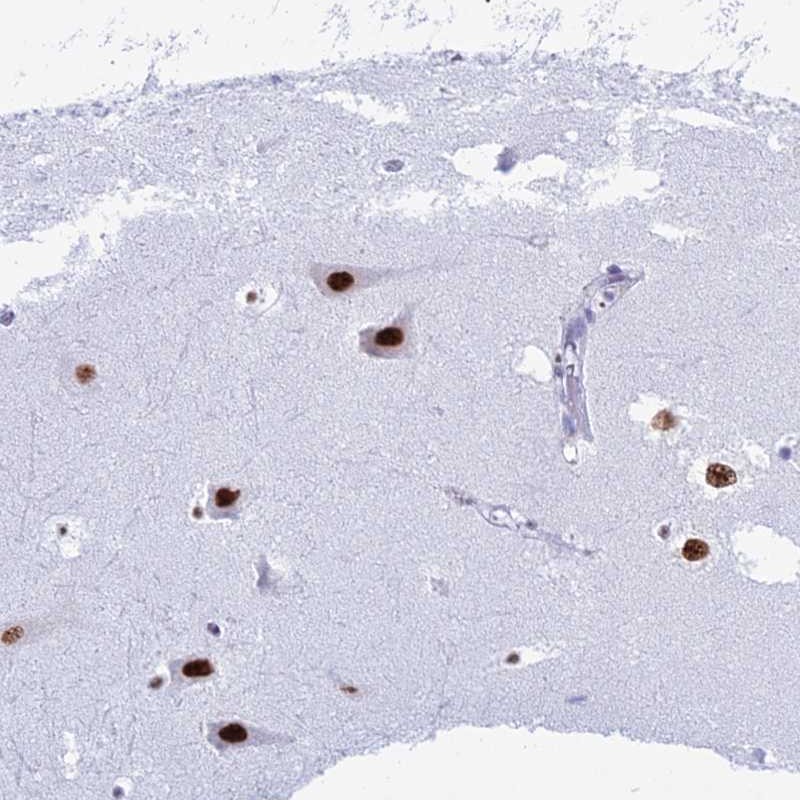 Atlas Antibodies Anti-RNPS1 Antibody