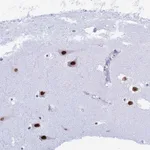Atlas Antibodies Anti-RNPS1 Antibody