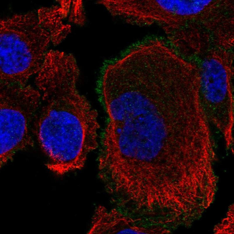 Atlas Antibodies Anti-ROBO4 Antibody