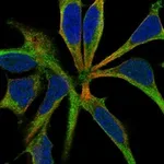 Atlas Antibodies Anti-ROBO3 Antibody
