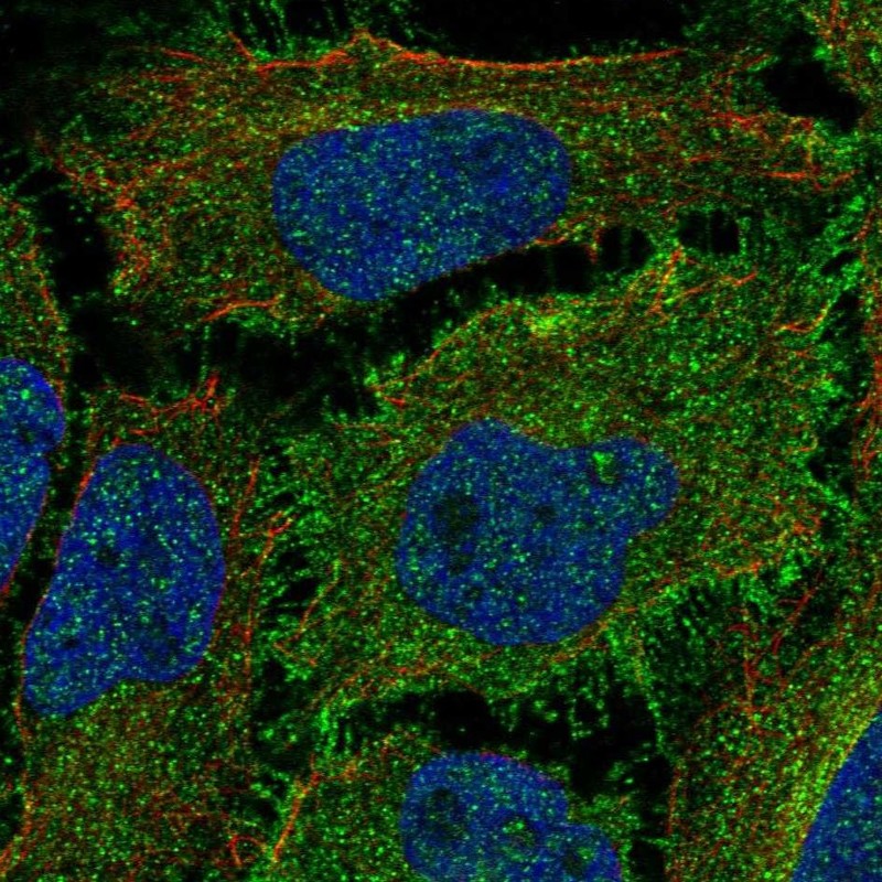 Atlas Antibodies Anti-ROBO1 Antibody