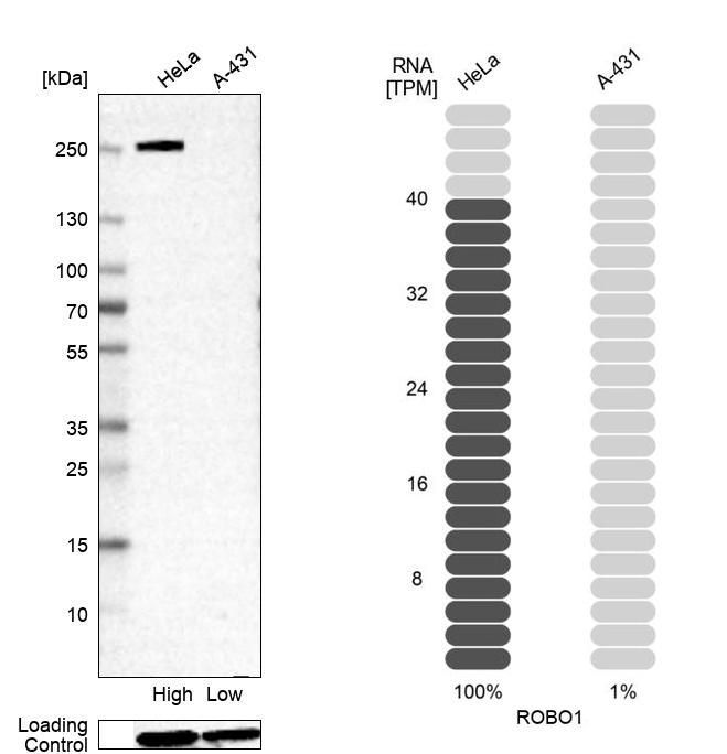 Atlas Antibodies Anti-ROBO1 Antibody