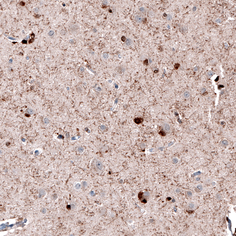 Atlas Antibodies Anti-ROBO2 Antibody