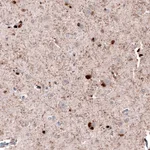 Atlas Antibodies Anti-ROBO2 Antibody