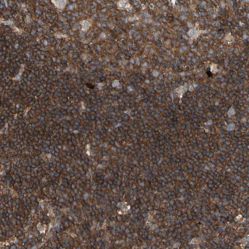 Atlas Antibodies Anti-ROCK1 Antibody