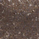 Atlas Antibodies Anti-ROCK1 Antibody