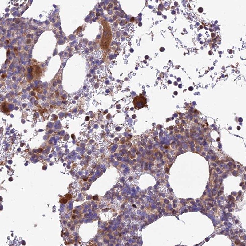 Atlas Antibodies Anti-ROCK1 Antibody