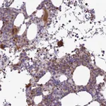 Atlas Antibodies Anti-ROCK1 Antibody