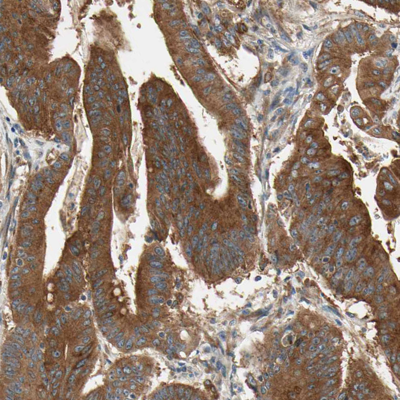 Atlas Antibodies Anti-ROCK2 Antibody