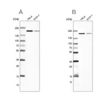 Atlas Antibodies Anti-ROCK2 Antibody