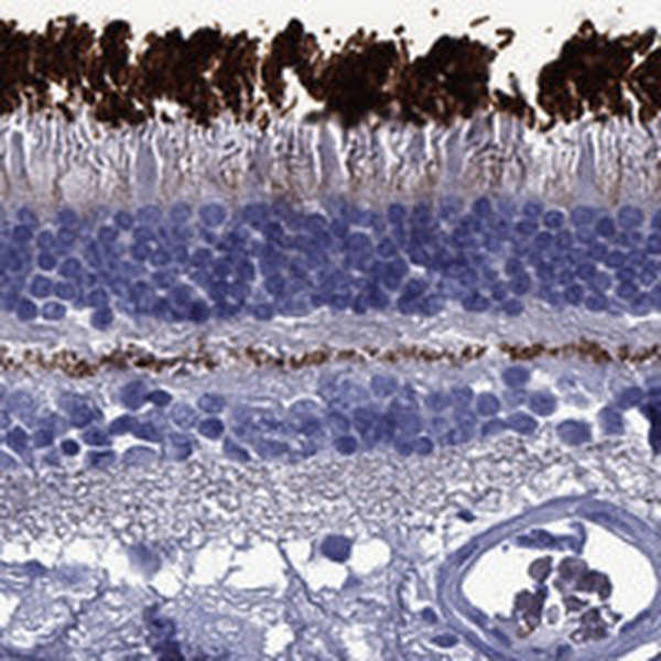 Atlas Antibodies Anti-ROM1 Antibody